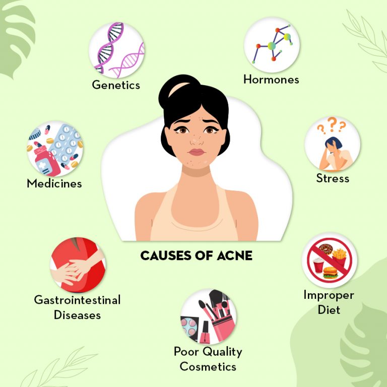 acne causes